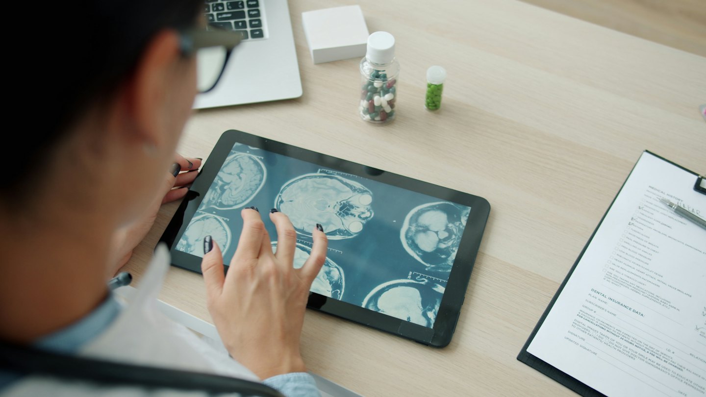 Medico che esamina scansioni cerebrali su un tablet alla scrivania.